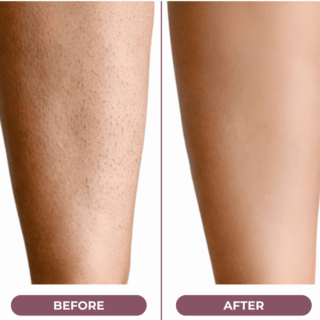 SilkGliss™ Two in One Electric Hair Trimmer: Double-Headed Women'S Electric Shaver