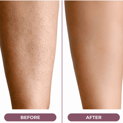 SilkGliss™ Two in One Electric Hair Trimmer: Double-Headed Women'S Electric Shaver