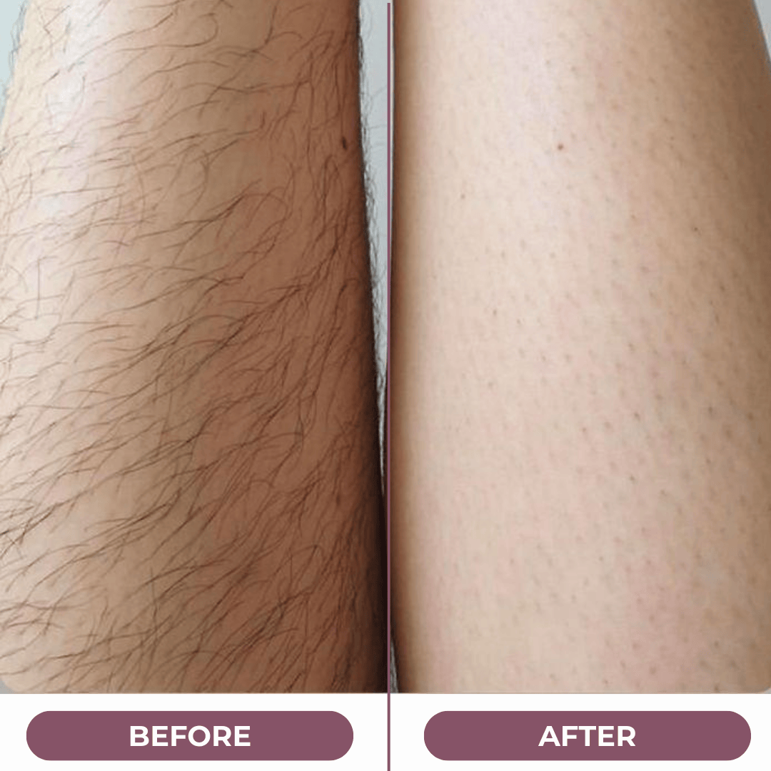 SilkGliss™ Two in One Electric Hair Trimmer: Double-Headed Women'S Electric Shaver