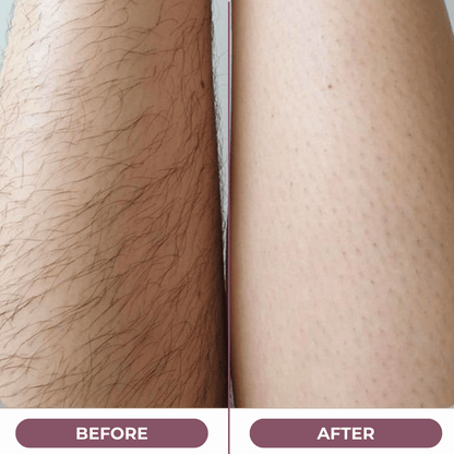 SilkGliss™ Two in One Electric Hair Trimmer: Double-Headed Women'S Electric Shaver