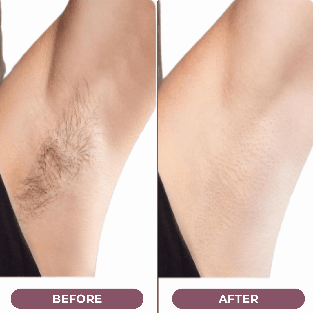 SilkGliss™ Two in One Electric Hair Trimmer: Double-Headed Women'S Electric Shaver
