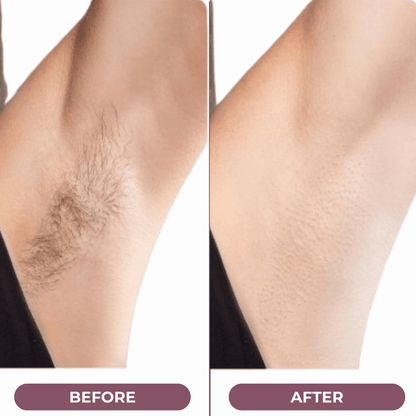 SilkGliss™ Two in One Electric Hair Trimmer: Double-Headed Women'S Electric Shaver