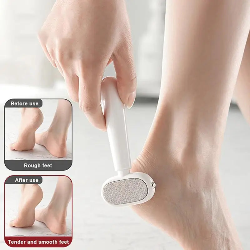 Dual-Sided Stainless Steel Foot Callus Remover & Pedicure Scraper
